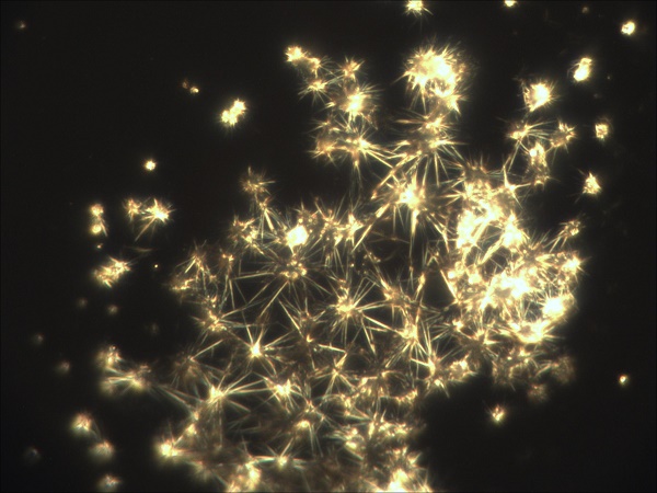 Mikroskopische Aufnahme von Schneeflocken-Wasser vom 19.2.2015. Bild: Umweltanalytiker - privat
