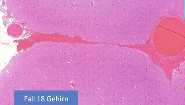 Bild: Screenshot: Pathologie-Konferenz/Wochenblick/Eigenes Werk