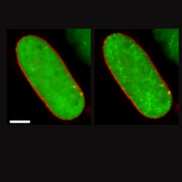 Die grün gefärbten Aktinmoleküle im rot markierten Zellkern (links) bilden, nachdem die Zelle mit einem Botenstoff behandelt wurde (rechts), Aktinfilamente, die das Erbgut strukturieren.
Quelle: Bild: Robert Grosse (idw)