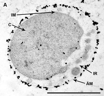Elektronenmikroskopische Darstellung einer Ignicoccus hospitalis Zelle. Die schwarzen Markierungen zeigen die Lage der Enzym-Komplexe (ATP-Synthase) in der äußeren Membran (ÄM) von Ignicoccus hospitalis (erreicht durch spezifische Antikörpermarkierung), Ultradünnschnitt, Maßstab: 1/1000 mm, (C = Cytoplasma; IM = innere Membran, ÄM = äußere Membran: IR = Intermembranraum).