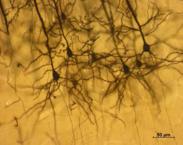 Neuronengruppe aus dem Kortex. Bild: Almut Schüz / Max-Planck-Institut für biologische Kybernetik