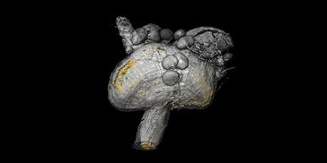 3D-Modell des Proventrikulus, eines speziellen Organs der Tsetsefliege: Die Verteilung der Trypanosomen ist anhand der fluoreszierenden Zellkerne in Gelb visualisiert. Quelle: (Bild: Lehrstuhl Zoologie I/eLife) (idw)