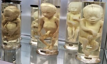Ungeborene Menschen (Embryos)
