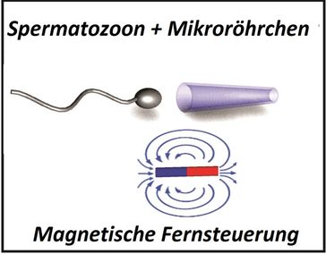 Ein Spermium wird in einem magnetischen Mikroröhrchen eingefangen und anschließend durch die magneti
Quelle: Prof. Dr. Oliver G. Schmidt, Veronika Magdanz (idw)