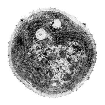 Elektronenmikroskopische Aufnahme des Cyanobakteriums Synechocystis PCC 6803 (Zelldurchmesser ca. 1.5 µm) Bild: RUB
