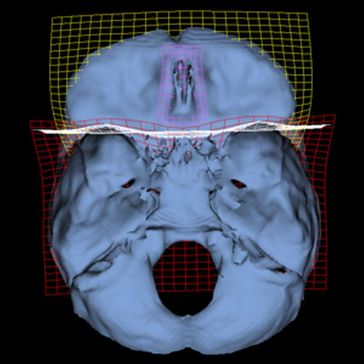 3D-Rekonstruktion der Schädelbasis. Die Gitter zeigen Veränderungen vom frühen Menschen zum Homo sapiens auf. Bild: 3D Morphometrics Lab, Paleoanthropology Group, Museo Nacional de Ciencias Naturales, CSIC (idw)