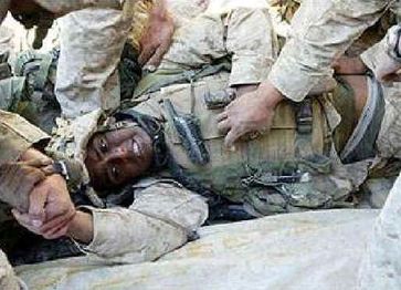 US Soldat im Irak, verwundet 2004