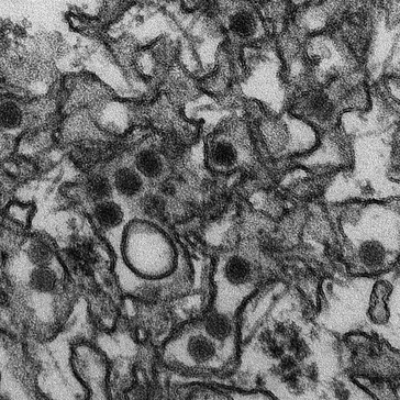 Elektronenmikroskopische Aufnahme von Zika-Virus-Partikeln (dunkel kontrastiert, etwa 40 nm im Durchmesser) in Zellen einer Zellkultur. Bild: CDC/ Cynthia Goldsmith - http://phil.cdc.gov/phil/details.asp?pid=20487, Gemeinfrei, https://commons.wikimedia.org/w/index.php?curid=46647793