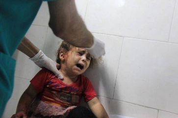 Gaza: A Palestinian child being treated at the Shefaa Hospital