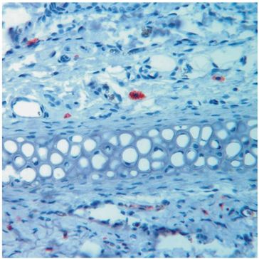 Fresszellen (Makrophagen, rot) im Bindegewebsraum der Haut. Abbildung: Nikolaus-Fiebiger-Zentrum für Molekulare Medizin