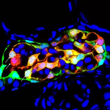Podozyten (blau), die Füßchenzellen der Niere, sitzen auf der Kapillare und wandern nicht auf ihr entlang. Quelle: Foto: Florian Siegerist (idw)