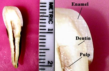 Zahnmark  (Pulpa) im Zahnquerschnitt
