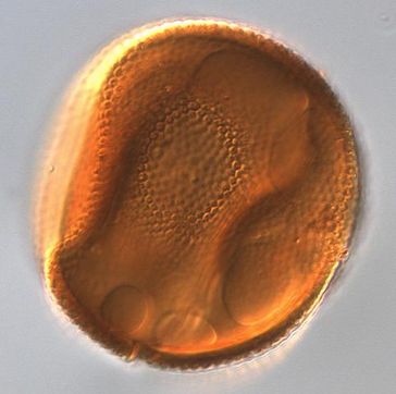 Zyste einer Grünalge der Gattung Pleurozonaria (50 x 50 Mikrometer). Diese Prasinophyte blühte während der frühen Jurazeit. Bild: Bas van de Schootbrugge.