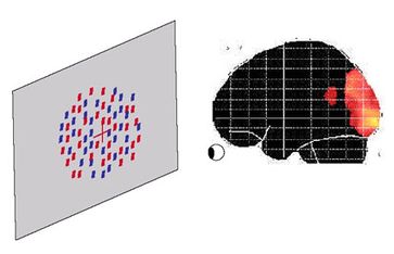 Beachtung bestimmter Reize bewirkt spezifische Hirnaktivität im Hinterkopf