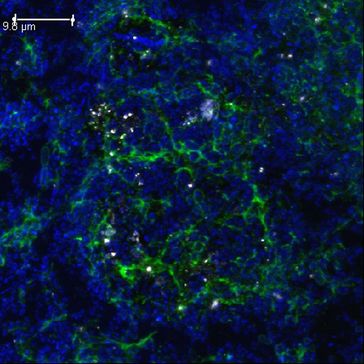 Das Bild zeigt stark vergrößert den Biofilm einer sulfatreduzierenden Bakterienart. Die Bakterien sind in blau zu sehen, dazwischen hat sich ein Biofilm ausgebildet, in dem in weiß ausgefallenen Dolomitkristalle zu sehen sind. Das Bild wurde aufgenommen mit einem konfokalen Laser-Scanning-Mikroskop
Quelle: ETH Zürich/Uni Zürich (idw)