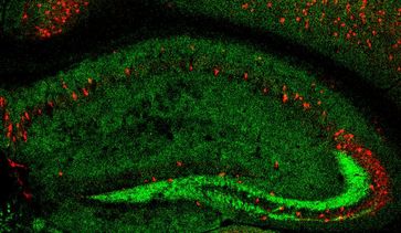 Nervenzellen des Hippokampus, einer Hirnregion, die bei Lernprozessen entscheidend ist. Grün dargestellt ist das Formin 2 Protein Quelle: Abb.: F. Sananbenesi (idw)