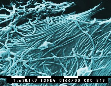 Elektronenmikroskopische Aufnahme von Ebolaviren