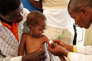 Ein Arzt misst den Armumfang eines unterernährten Kindes im Kongo