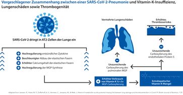 Zusammenhang zwischen einer SARS-CoV-2-Pneunomie und Vitamin-K-Insuffizienz, Lungenschäden sowie Thrombogenität  Bild: Dr. Jacobs Institut Fotograf: Dr. Jacobs Institut