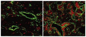 Der normale Thymus einer Maus (links) enthält nur wenige B-Zellen (rot). Wenn das Gen FOXN4 aktivier
Quelle: MPI für Immunbiologie und Epigenetik (idw)