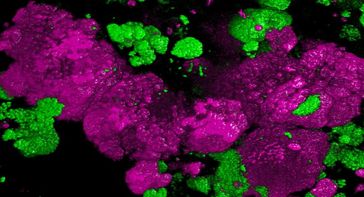 Die Kolonie besteht aus mehreren Tausend einzelner Nitrospira-Zellen. Kolonien anderer Bakterien sind grün dargestellt. Die Bakterien wurden durch Fluoreszenz in situ-Hybridisierung visualisiert. Quelle: Copyright: Holger Daims (idw)