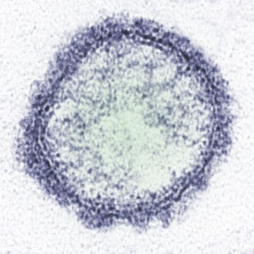 Schmallenberg Virus