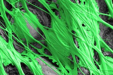 Rasterelektronenmikroskopische Aufnahme einer Haftscheibe (grün), die auf einem Blatt (grau) gesponn
Quelle: Foto: Jonas Wolff (idw)