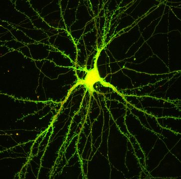 Kultivierte Nervenzelle (rot). Nach Stimulation hat sich Copine-6 (grün) an den zahlreichen Synapsen der Empfängerzelle angereichert. Quelle: Universität Basel, Biozentrum (idw)