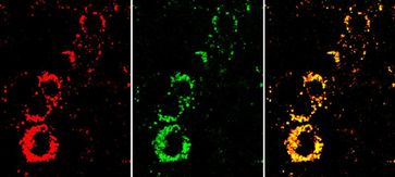 Nanosensoren zeigen durch das gelbe Signal im Überlagerungsbild (rechts), dass die Zellen aktiv sind. Wären sie in einem schlechten Zustand , wären sie deutlich röter. Mitte: Signal des Indikatorfarbstoffs. Links: Signal des Referenzfarbstoffs. Bild: Fraunhofer EMFT (idw)