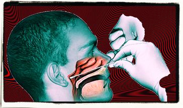 Coronatest: Mit einem nicht überpfüften, experimentellen Test, der nichts über Viren, Erkrankungen oder ähnliches aussagt, etwa 4 cm tief eingeführt - für praktisch alle eine Qual und Schmerzhaft (Symbolbild)