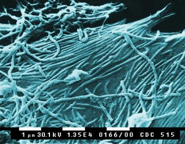 Elektronenmikroskopische Aufnahme von Ebolaviren