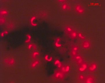 Photosynthese-Aktivität der Grünalgen, mit Fluoreszenz sichtbar gemacht.
Quelle:  (idw)