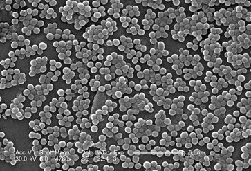 Ausschnitt aus einer MRSA-Kolonie (elektronenmikroskopische Aufnahme)