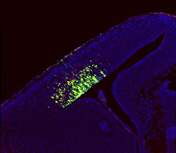 Abgebildet ist ein Schnitt durch die Großhirnrinde eines Mausembryos. Die Zellen, in die eine erhöhte Menge des cdk4/cyclinD1-Komplexes eingebracht wurde, sind grün und rot angefärbt. Bild: Christian Lange und Dr. Federico Calegari