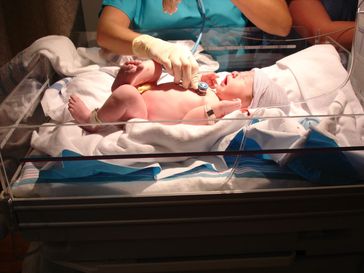 Untersuchung eines Neugeborenen