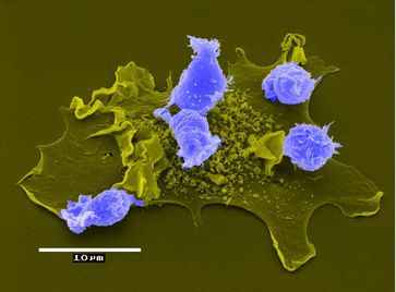 Stimulation von T-Zellen (blau) durch eine dendritische Zelle
Quelle: Foto: HZI/Kurt Dittmar (idw)