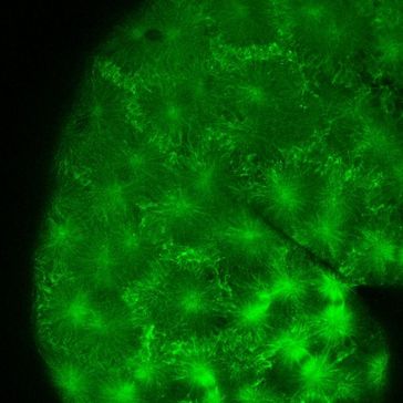 Unter grünem Fluoreszens-Licht lassen sich die Zellstrukturen, hier die Mikrotubuli, an lebenden Fischembryonen beobachten. (Bild: NIH, KIT)
Quelle:  (idw)