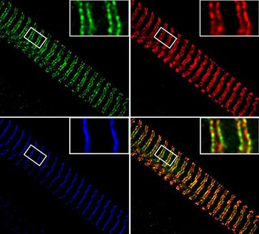 Muskelfibrillen sind die Bausteine der Muskelzellen, die regelmäßig quergestreift sind (blau). Ihre Elastizität erhalten sie durch das Riesenprotein Titin (rot). Das methylierte Hitzeschockprotein Hsp90 bindet zusammen mit der Methyltransferase Smyd2 (grün) an die elastischen Titinfedern der Muskelfibrillen und stabilisiert sie. Die Teilabbildung unten rechts zeigt die gemeinsame Lokalisation von Smyd2 und elastischer Titinregion.
Quelle: Abbildung: Prof. Wolfgang A. Linke (idw)