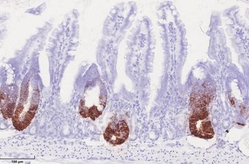 HSP60 in Mitochondrien kontrolliert die Stammzellproliferation im Darmepithel. HSP60-negative Krypten im Darm zeichnen sich durch den Verlust von braungefärbten Stammzellen aus, während HSP60-positive Darmareale eine verstärkte Stammzellproliferation zeigen. Bild: Team Haller/ TUM