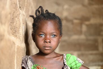 Die achtjährige Valentine aus Kamerun Bild: CBM Fotograf: Tobias Pflanz