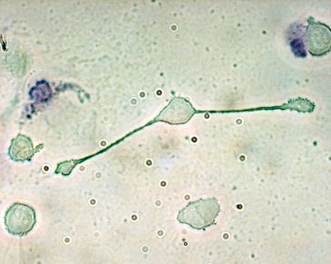 Makrophagen  Bild: Obli at en.wikipedia