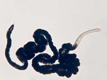 Plattwurm aus dem Belize Barriere Riff in der West-Karibik. Die symbiotischen Bakterien erscheinen schwarz im hinteren Bereich des ca. 6 mm langen Wurms. Bild: Harald Gruber-Vodicka