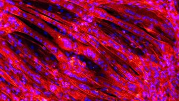 Der Natur nachgeahmt: Ein Geflecht aus Muskelfasern wächst auf einem Gerüst auf gesponnenem Kunststoff. Unter dem konfokalen Laser-Scanning-Mikroskop erscheinen Muskelfasern rot und Zellkerne blau. Bild: Lukas Weidenbacher