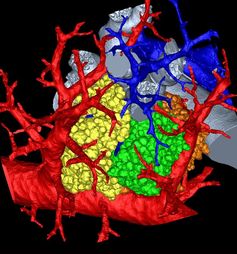 Dreidimensionale Rekonstruktion von drei «Lungentrauben» (Acini) der Mauslunge an den Endbronchien (grau), zusammen mit den Endästen der Lungenarterien (blau) und der Lungenvenen (rot).
Quelle: Bild: Dr. Dragos Vasilescu, University of Iowa. (idw)