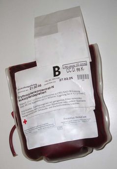 Erythrozytenkonzentrat (zelluläre Blutbestandteile) in einer Bluttransfusion (Symbolbild)