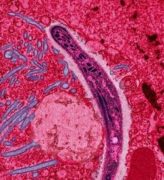 Malaria: Plasmodium im Zytoplasma einer befallenen Zelle (EM-Aufnahme in Falschfarben)