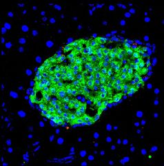 Langerhans'sche Insel des Pankreas mit Insulin-produzierenden Zellen (grün).
Quelle: MPI f. Herz- und Lungenforschung (idw)