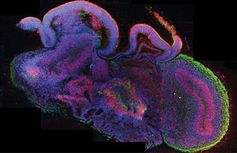 Querschnitt eines vollständigen cerebralen Organoids. Bild: de.imba.oeaw.ac.at