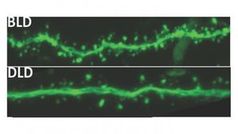 Gehirnaktivitäten nach Lichtkur (oben), Dämmerlicht-Aufenthalt. Bild: msu.edu