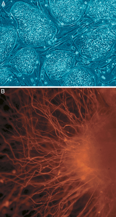Menschliche embryonale Stammzellen. A: undifferenzierte Kolonien. B: Neuron-Tochterzelle